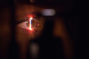 retina health